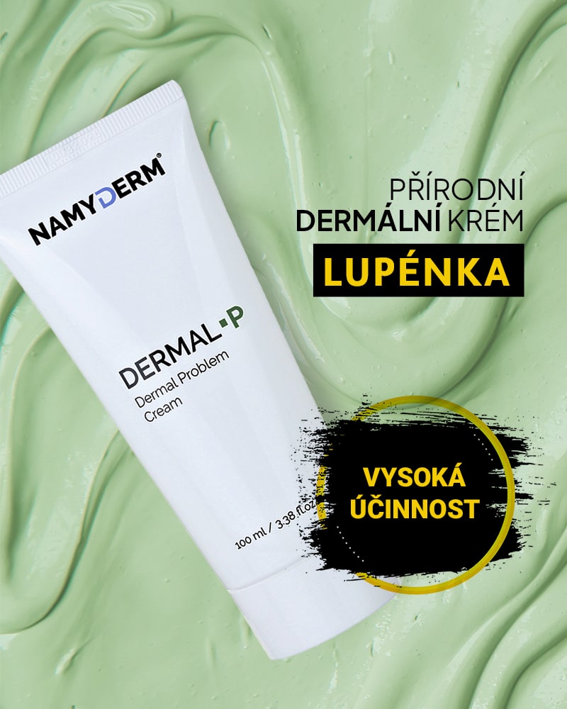 Dermal P – přírodní dermální krém na lupénku